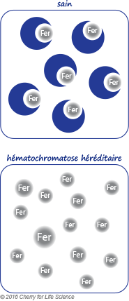 hémochromatose héréditaire