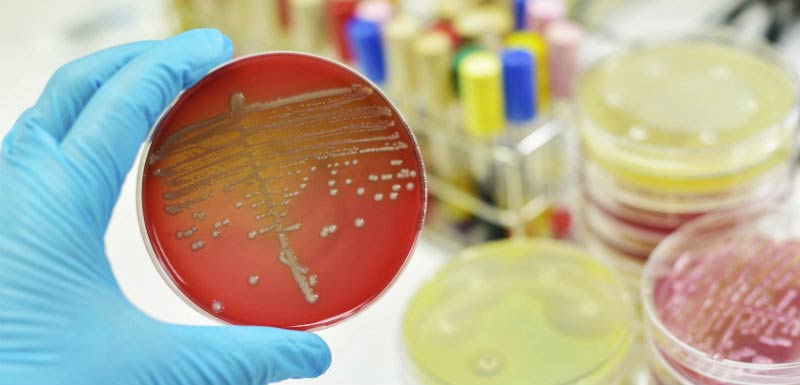 analyse laboratoire des antibiotiques