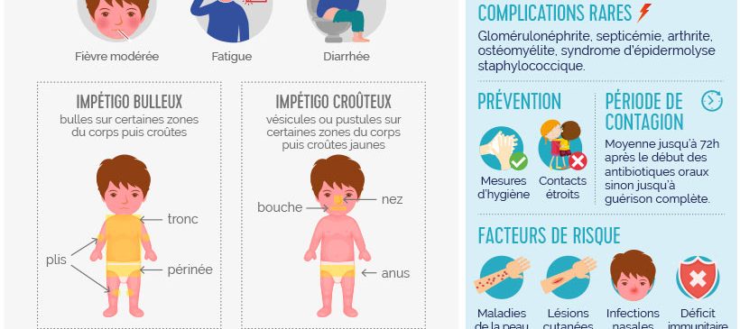 infographie expliquand l'impétigo