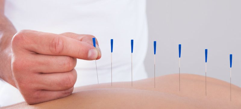 acupuncture services urgence