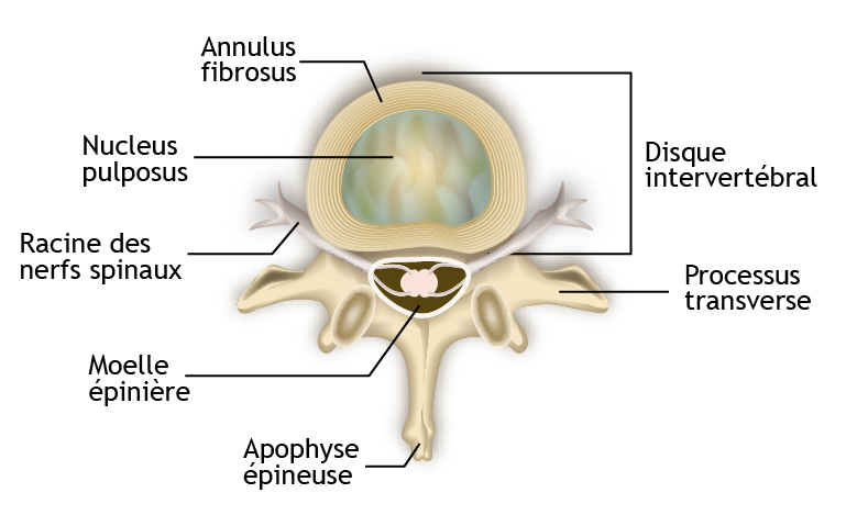 Anatomie hernie discale