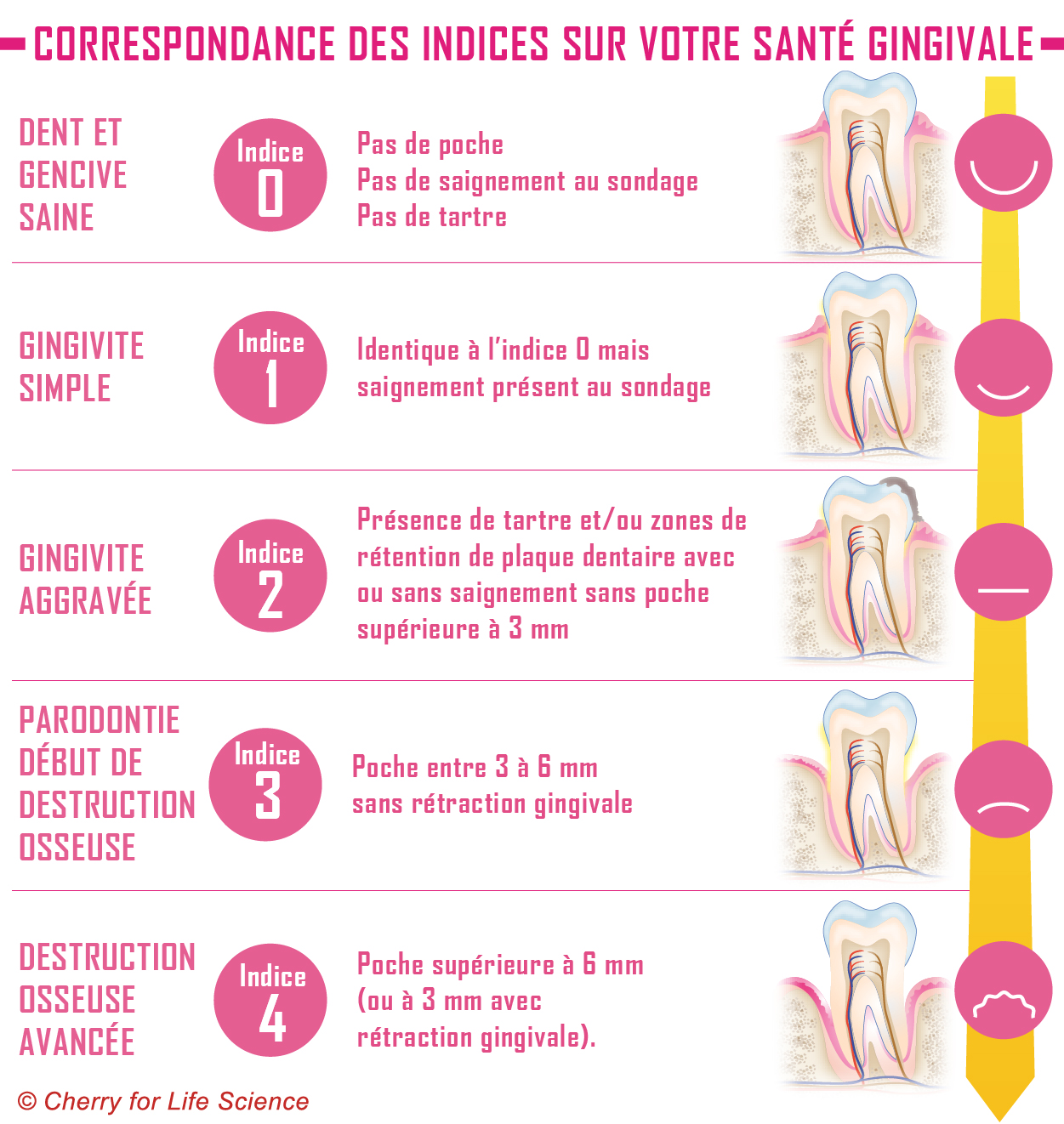 Correspondance des indices sur votre santé gingivale