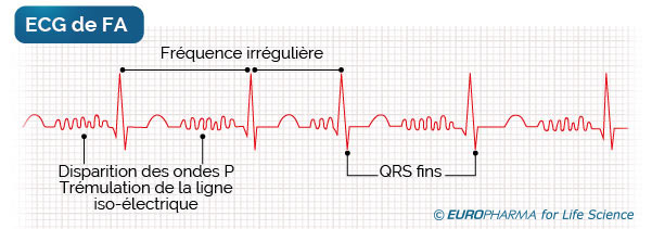 ECG - FA