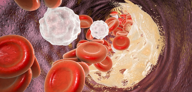 atherosclerose-autophagie