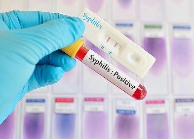 Syphilis