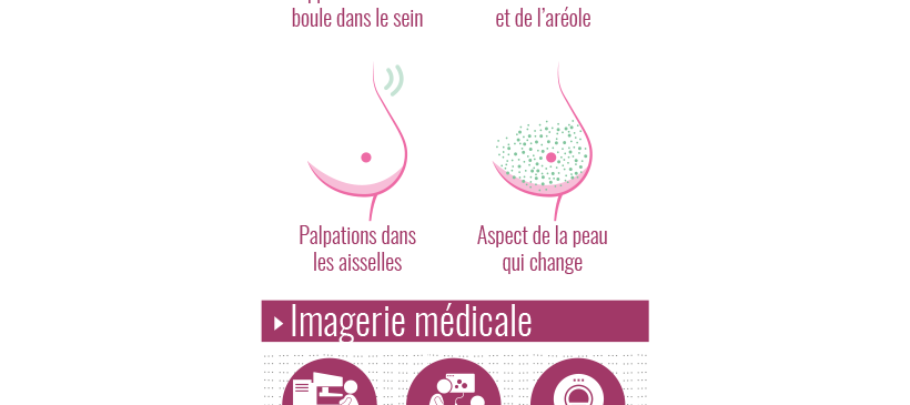 Infographie : dépistage du cancer du sein