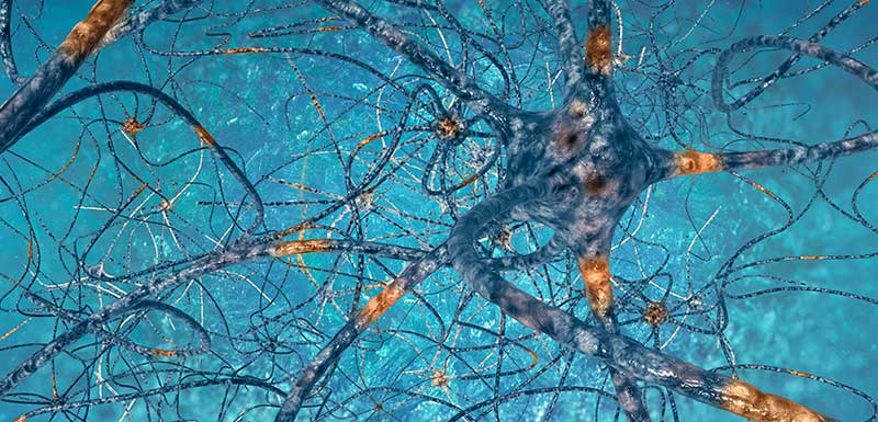 neurones et complications neurologiques