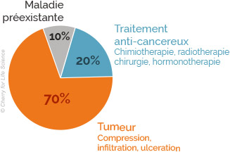 douleur du cancer