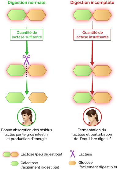 intolérance au lactose