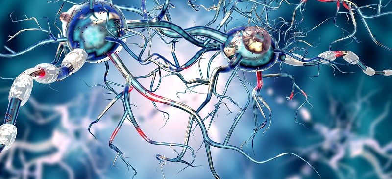 Une équipe de chercheurs vient de montrer que le calcium joue un rôle clef dans la physiopathologie de la maladie de Parkinson. Il favoriserait la formation des corps de Lewy.