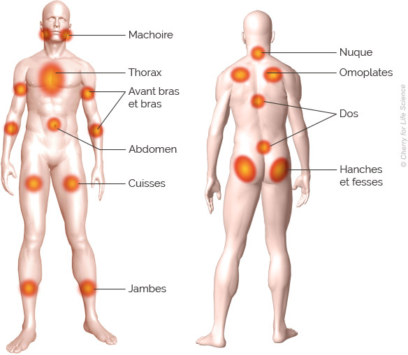 zones douloureuses