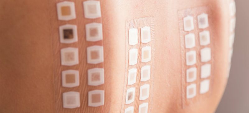 Patch-test sur l’arrière de la patiente pour prescription médicaments.