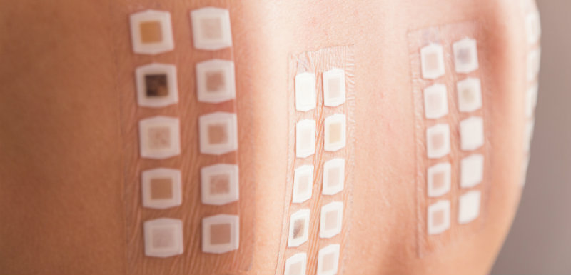 Patch-test sur l’arrière de la patiente pour prescription médicaments.