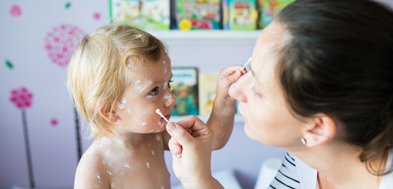 Un enfant ayant la rougeole