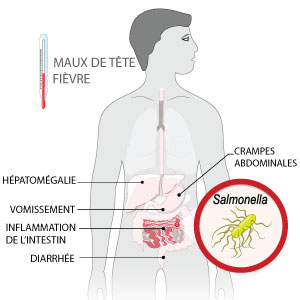 symptômes salmonellose