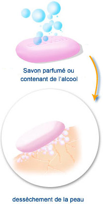 radiodermite : utiliser un savon sans alcool