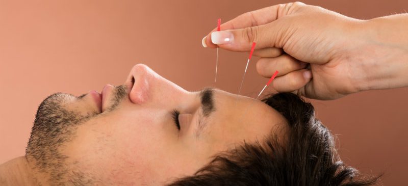 Journées mondiales de l'acupuncture