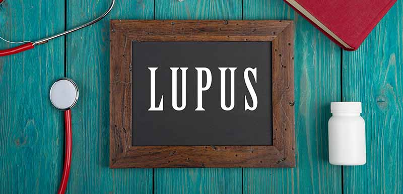 Lupus