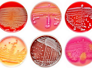 colonies de bactéries dans une boîte à pétri pour vérifier infections à streptocoques