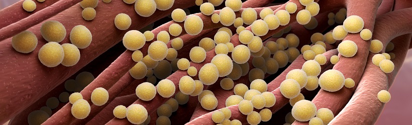 Staphylococcus aureus