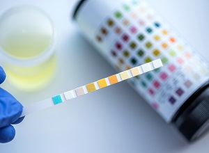 trichomonase diagnostic