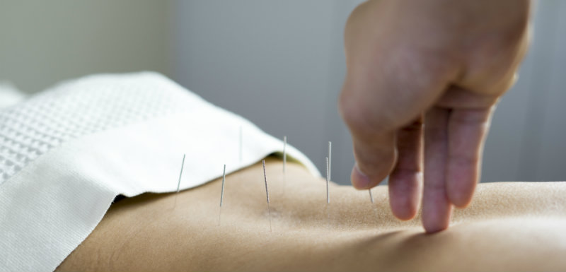 acupuncture-douleur-cancer