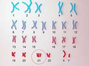 caryotype-humain-trisomie