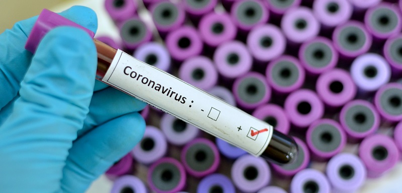 coronavirus