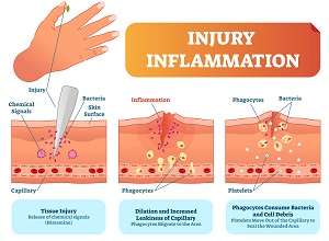 inflammation-3