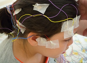 Electrodes sur la tête d'un enfant