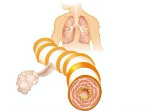 emphyseme-pulmonaire-anatomie