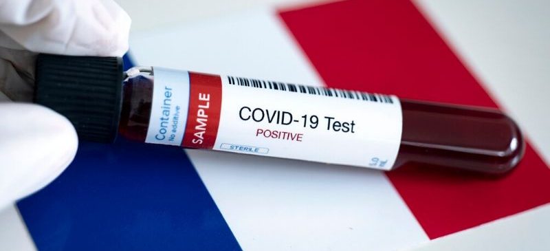 Un test sérologique positif du coronavirus (covid-19) devant un drapeau français en fond