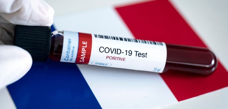 Un test sérologique positif du coronavirus (covid-19) devant un drapeau français en fond