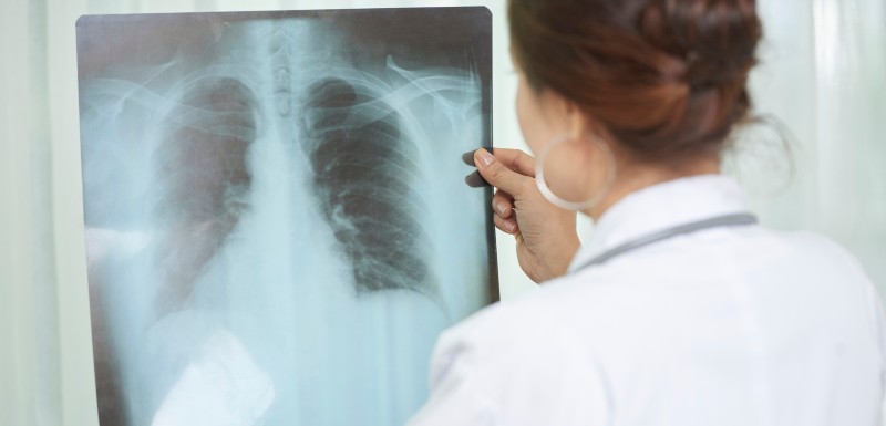 Médecin femme qui analyse une radiographie des poumons