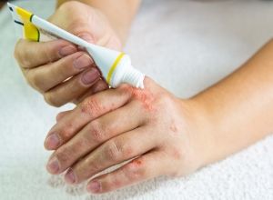 Personne qui se met de la crème sur les mains