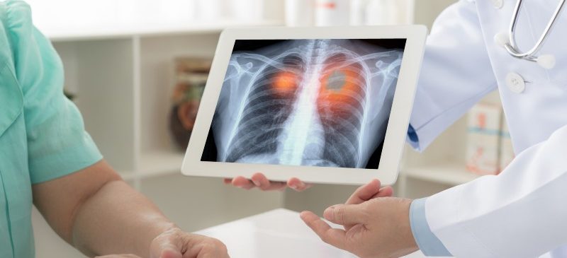 médecin qui montre à son patient la radiographie de son poumon