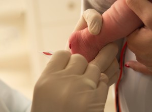 test de Guthrie, prise de sang au pied d'un bébé