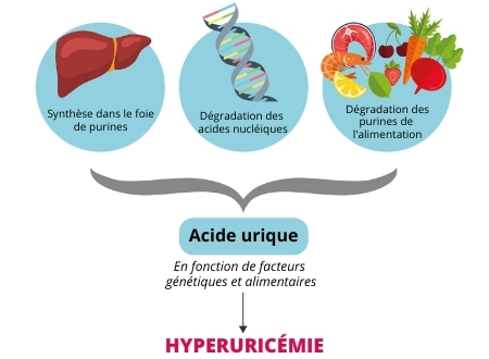 schéma pour décrire une hyperuricemie