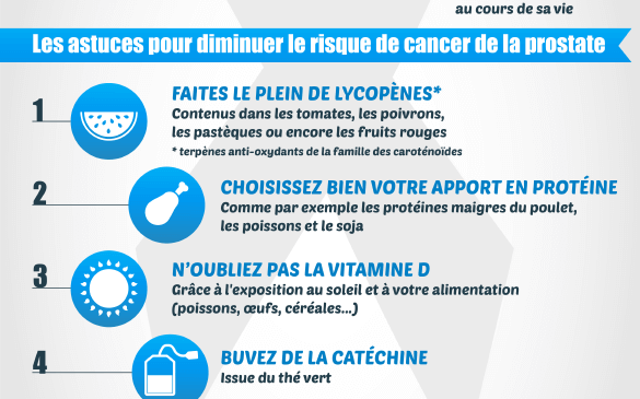 Infographie sur le cancer de la prostate en France