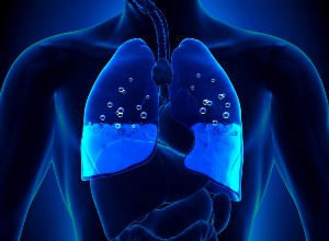 schéma pour représenter un Œdème pulmonaire