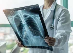 médecin qui regarde une radiographie