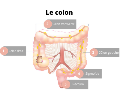 schéma du colon pour expliquer la colite