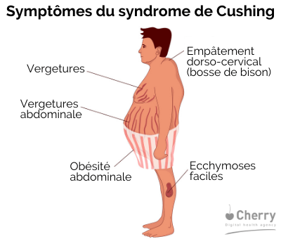 Les symptômes du syndrome de Cushing