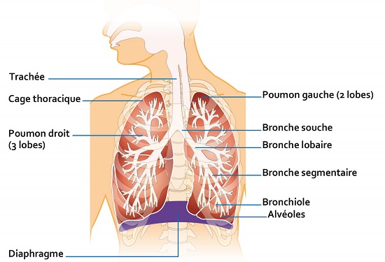 Schema Syndrome de détresse respiratoire aiguë