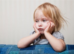 jeune enfant atteint de rubéole