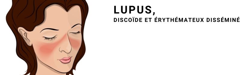 lupus