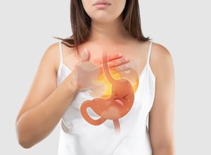 femme avec un reflux gastro-œsophagien