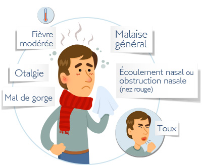 symptômes du rhume rhinopharyngite