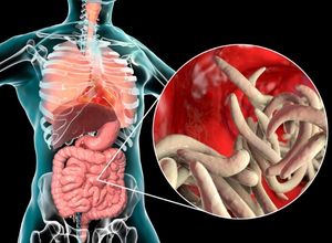 ers parasites dans l’intestin grêle humain