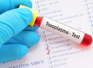 Toxoplasmose analyse sanguine